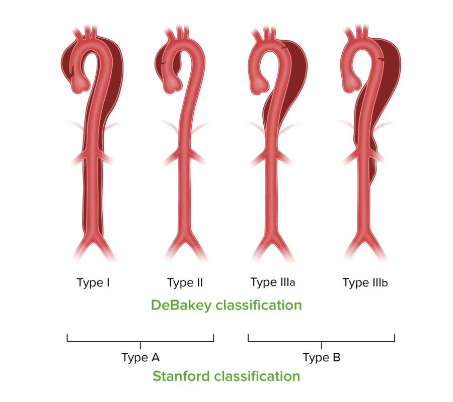 Aufsteigende Und Absteigende Aorta