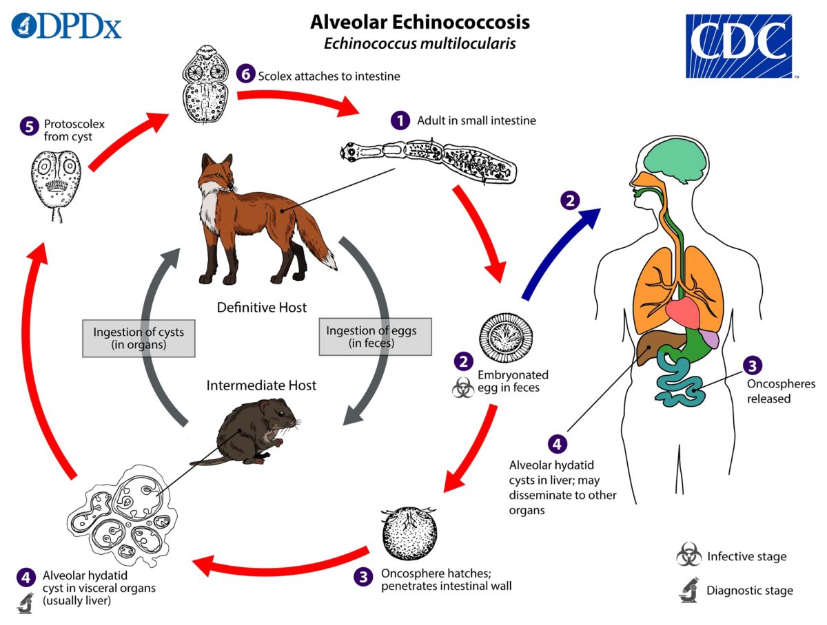 Echinokokkus/ Echinokokkose - E-Learning mit Lecturio