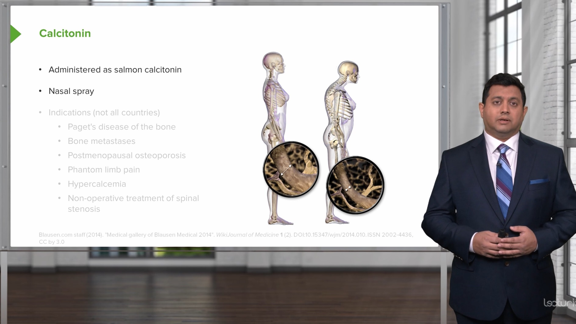 CushingSyndrom ELearning mit Lecturio