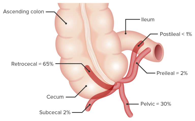 Colon, Caecum, Appendix vermiformis: Anatomie | Lecturio