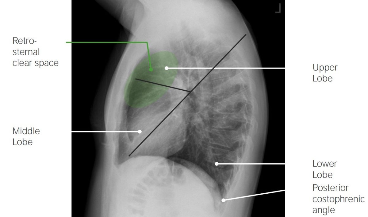 Mrt Abdomen Lunge Mit Drauf www.lecturio.de