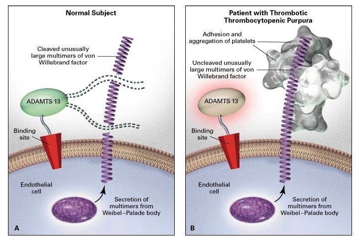 Thrombotisch-thrombozytopenische Purpura (TTP) - E-Learning mit Lecturio