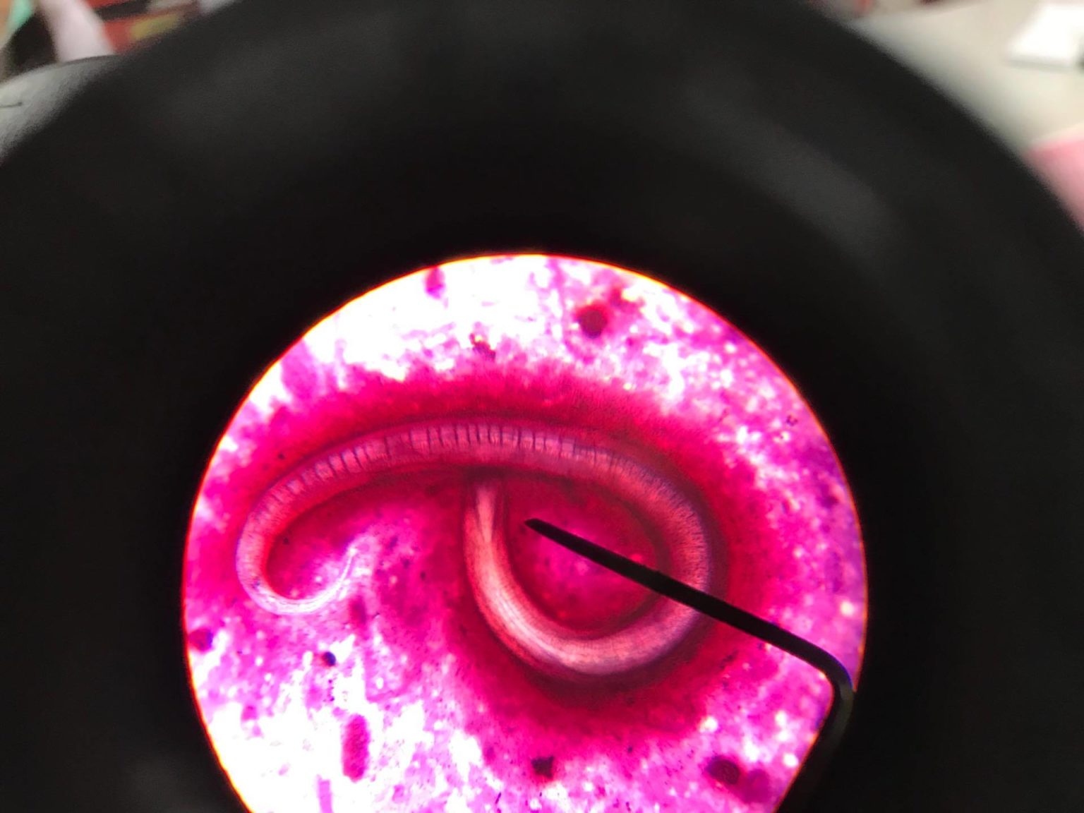 Bilharziose Schistosoma/Schistosomiasis Lecturio