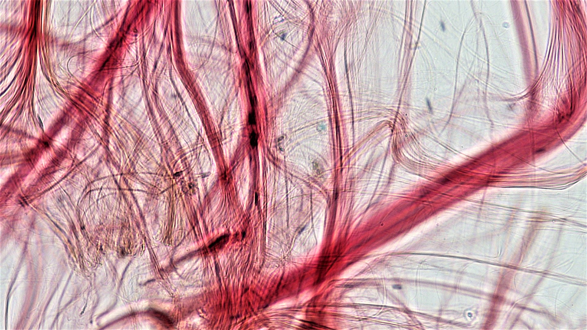 Bindegewebe: Histologie (Arten, Aufbau, Funktion) | Lecturio