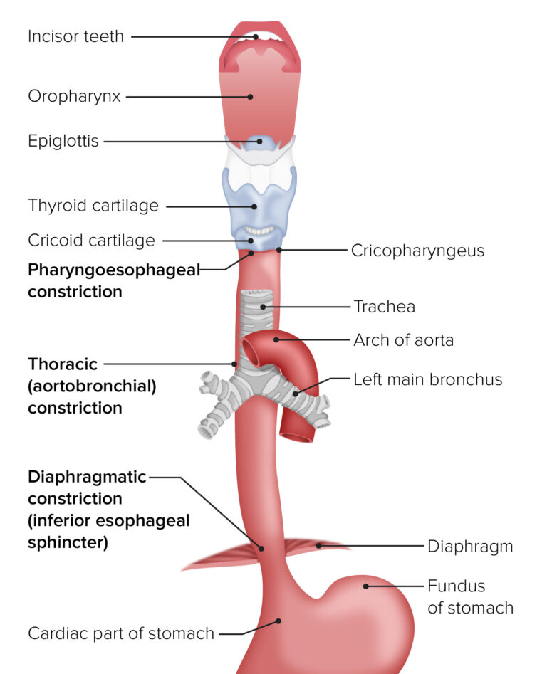 Gastroösophageale Refluxkrankheit (GERD) ELearning mit Lecturio