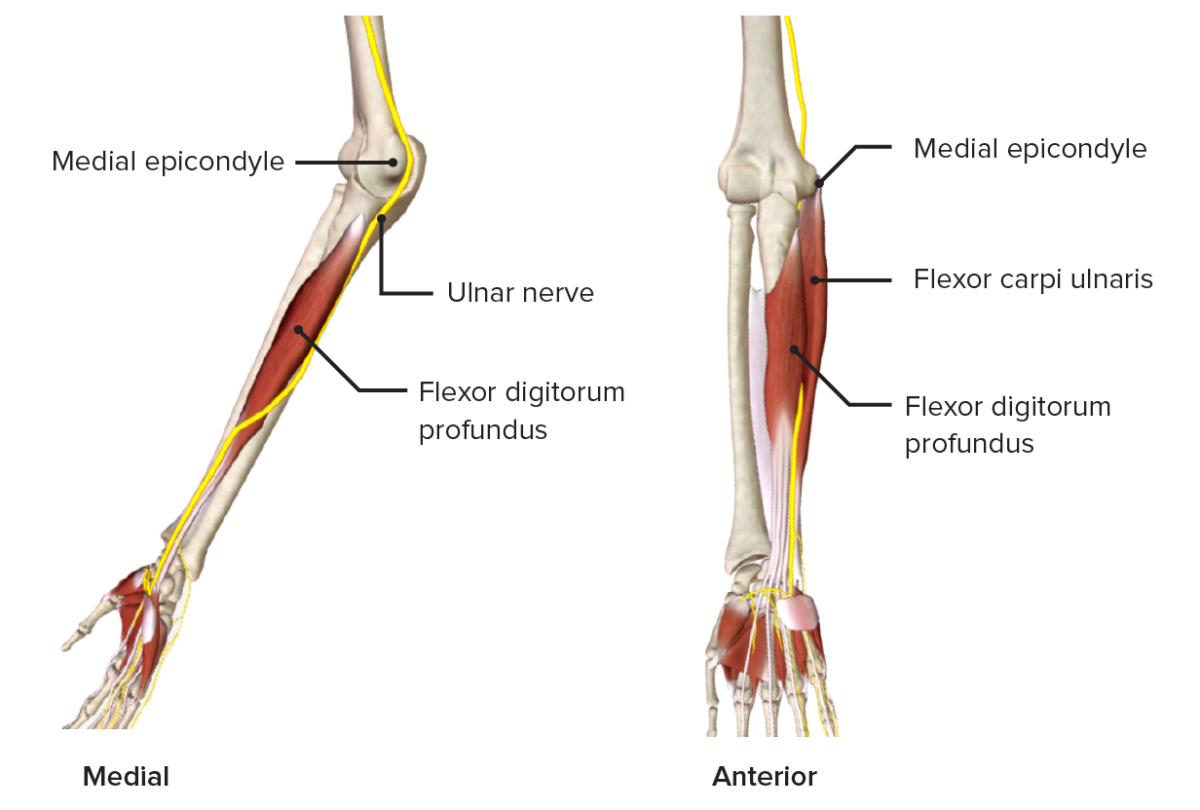 Mononeuropathie Plexopathie Symptome Therapie Lecturio