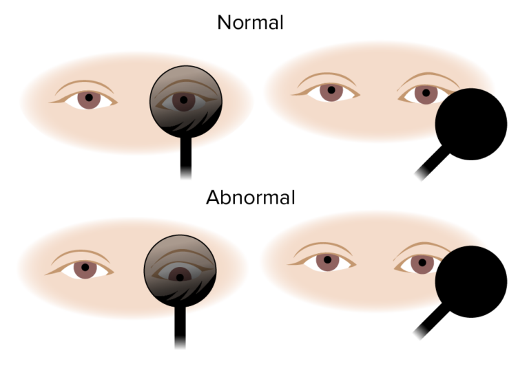 Schwindel ELearning mit Lecturio